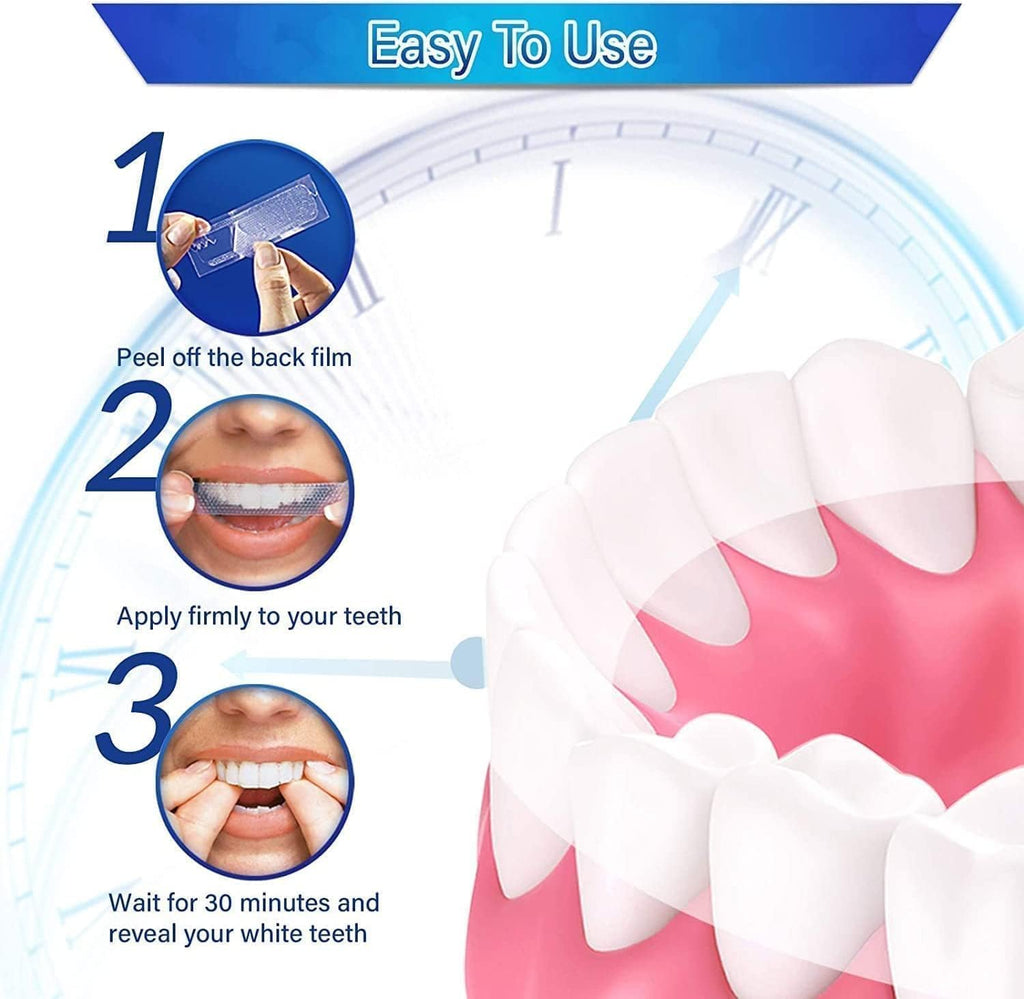 Vinmall Zahnaufhellungsstreifen Whitening Strips Minze 14 Anwendungen