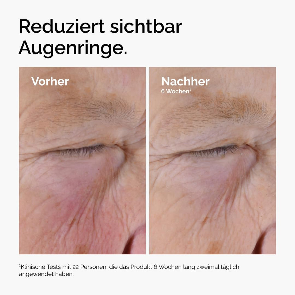 The Ordinary Caffeine Solution 5% + EGCG 30 ml Augenserum gegen Augenringe