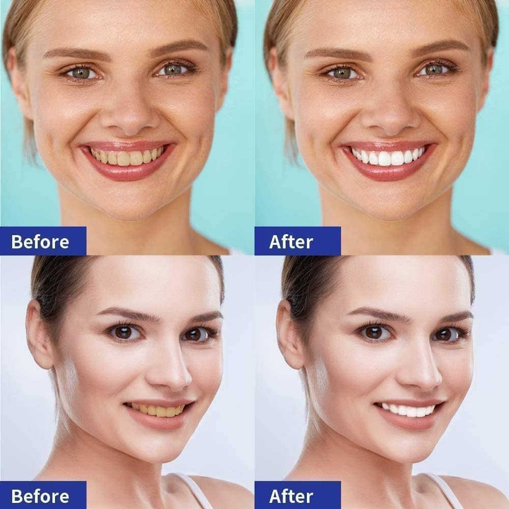 Vinmall Zahnaufhellungsstreifen Whitening Strips Minze 14 Anwendungen