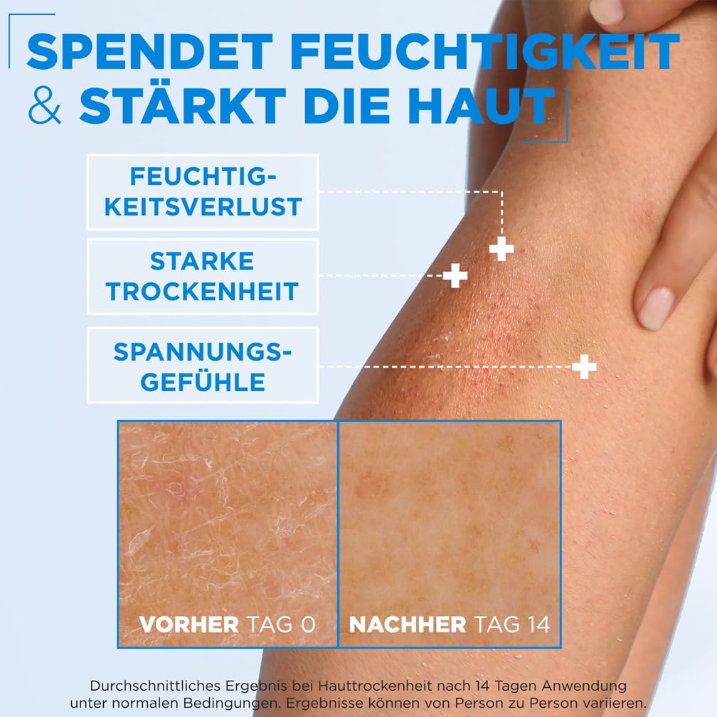 Mixa Ceramide Protect Koerpercreme fuer sehr trockene Haut