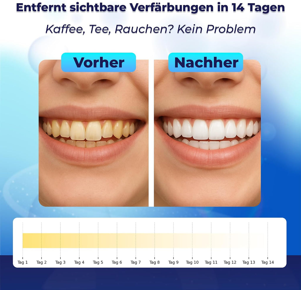 Whitening Strips Zahnaufhellungsstreifen 28 Stueck fuer empfindliche Zaehne