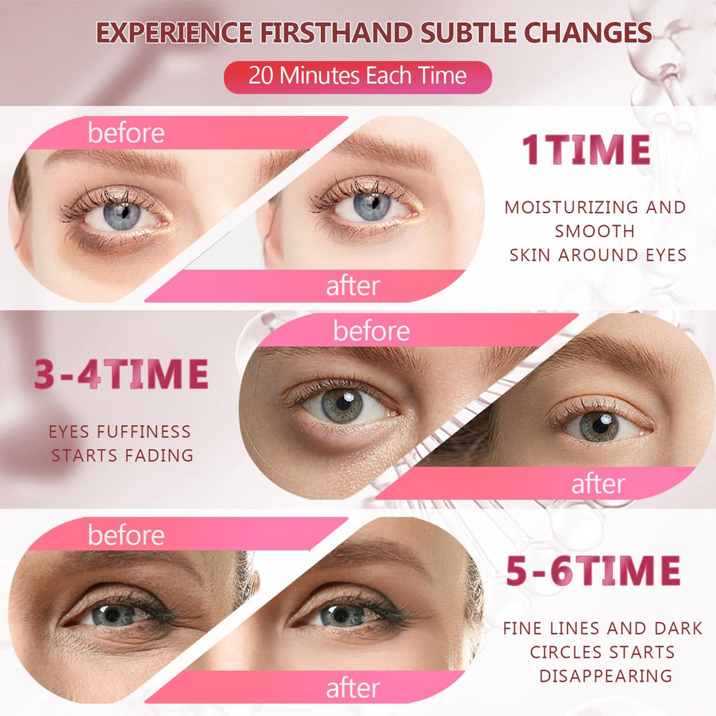 Kollagen Augenpads 60 Stueck Pink mit Hyaluron Feuchtigkeit Anti-Aging