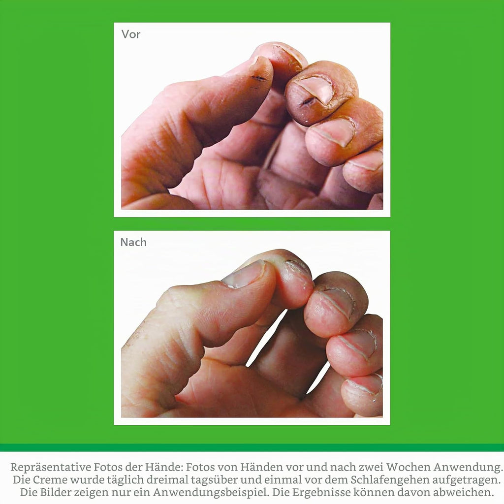 O’Keeffe’s Working Hands Handcreme gegen sehr trockene rissige Haende