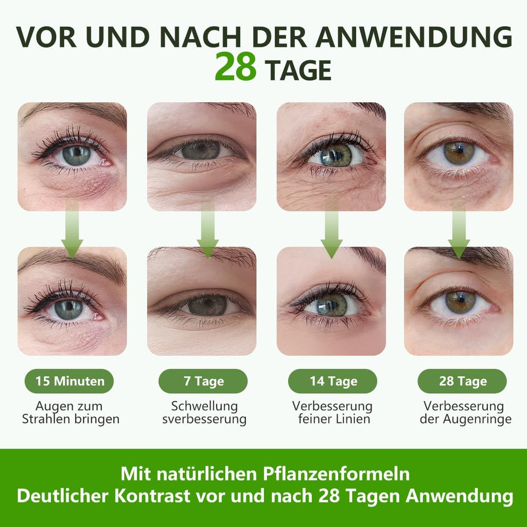 Augenpads 60 Stueck Hyaluron Avocado gegen Augenringe Falten