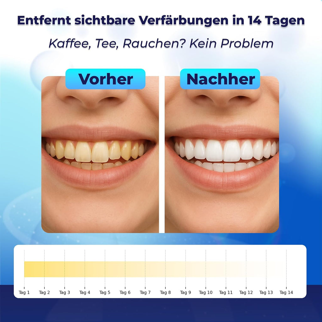 Whitening Strips Zahnaufhellungsstreifen 28 Stueck fuer empfindliche Zaehne