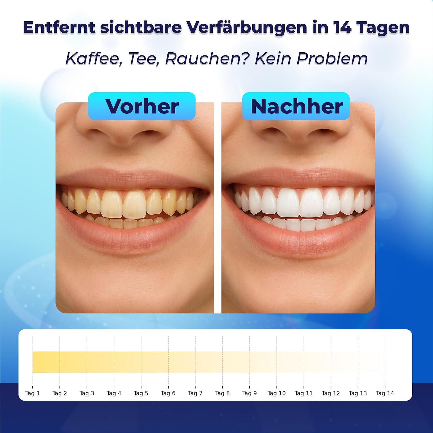 Whitening Strips Zahnaufhellungsstreifen 28 Stueck fuer empfindliche Zaehne