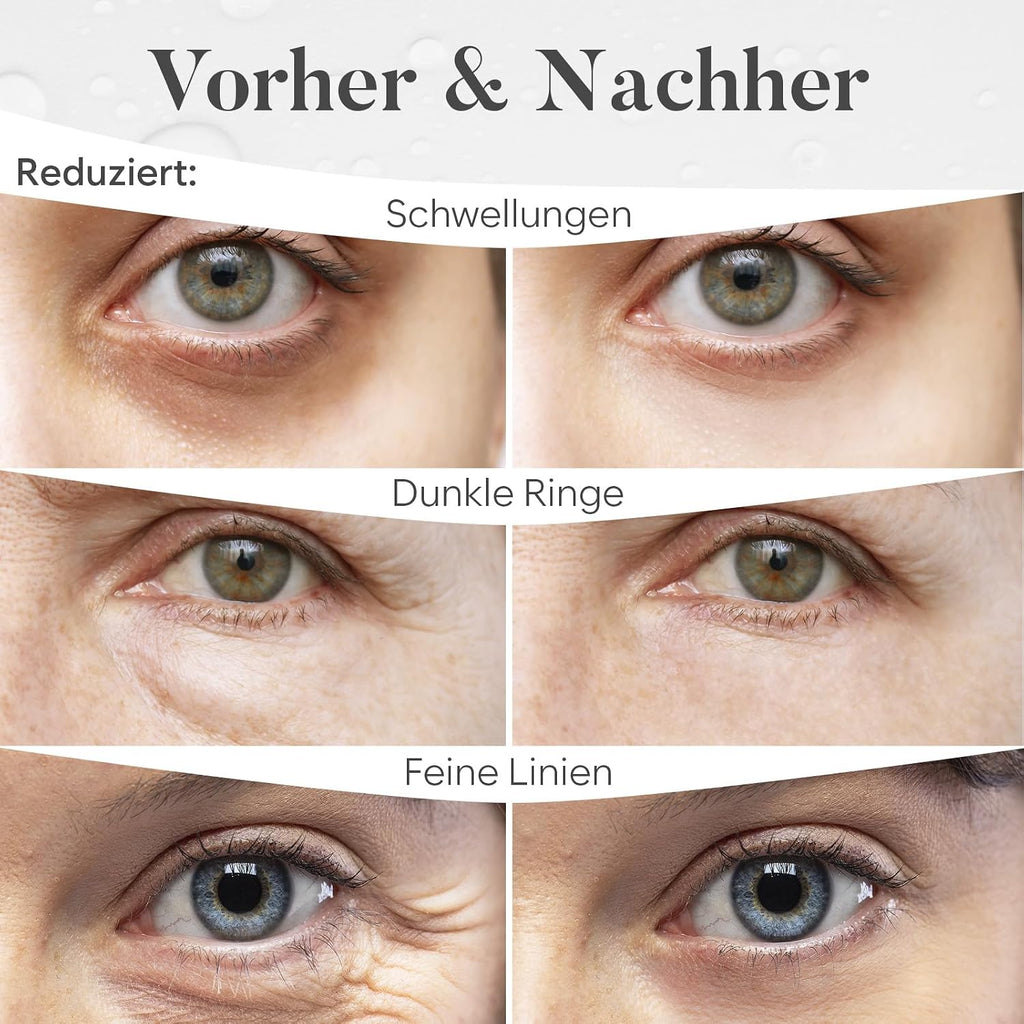 Augenpads 20 Paare mit Niacinamid und Hyaluron - Gel Augen Pads