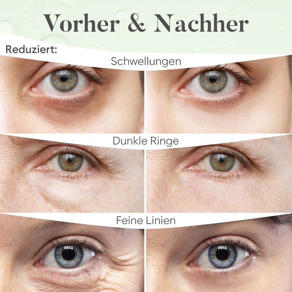 Augenpads 20 Paare mit Niacinamid und Hyaluron - Gel Augen Pads