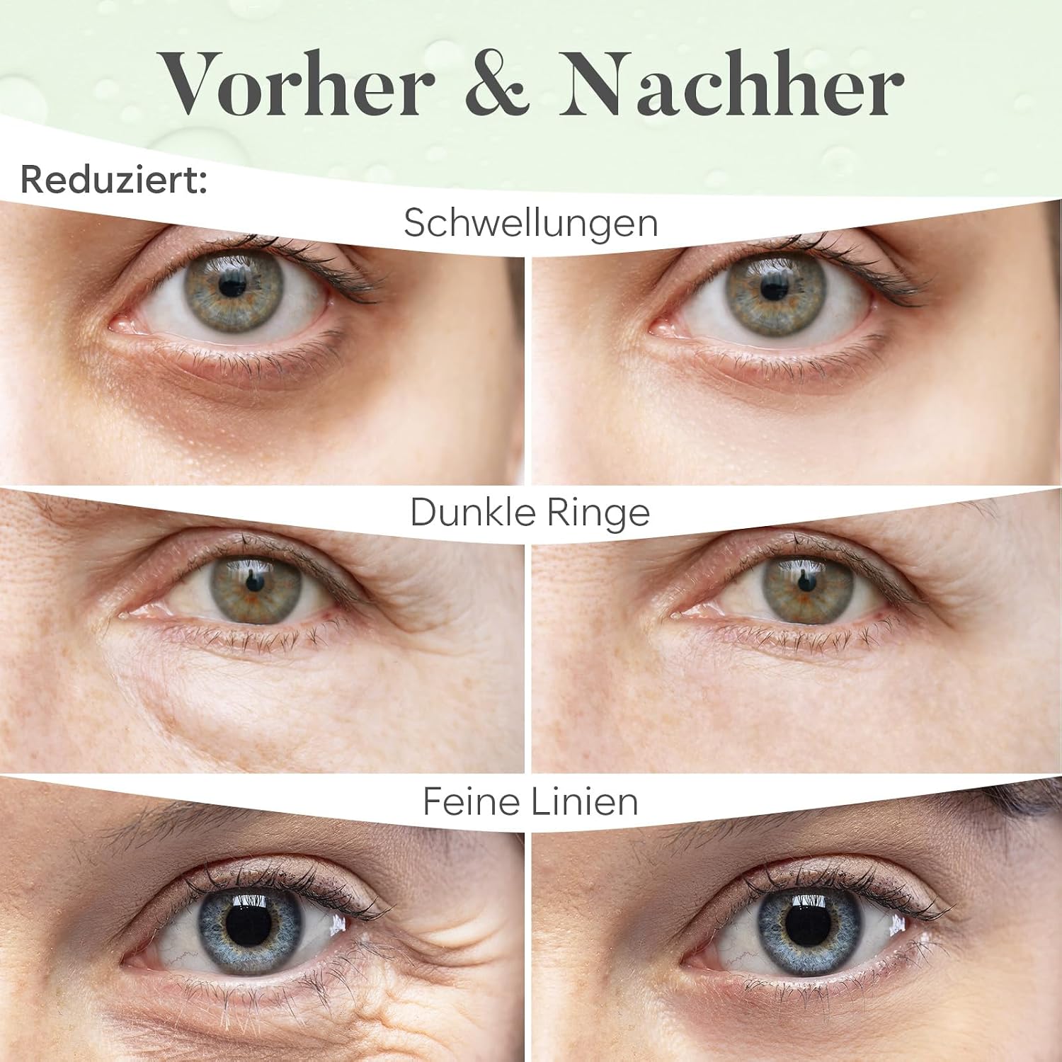 Augenpads 20 Paare mit Niacinamid und Hyaluron - Gel Augen Pads