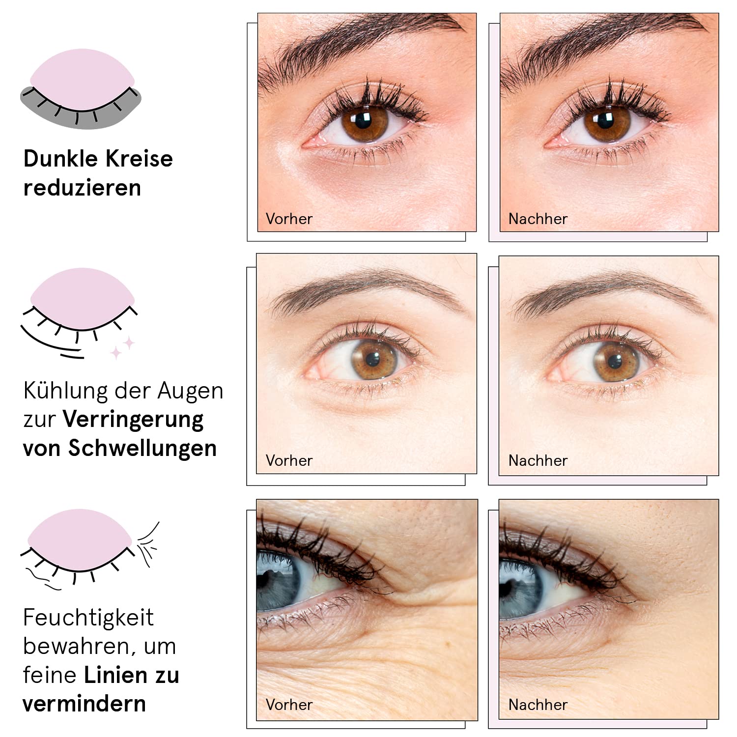 Grace & Stella Gel Augenpads 48 Paare gegen Augenringe Traenensaecke Falten