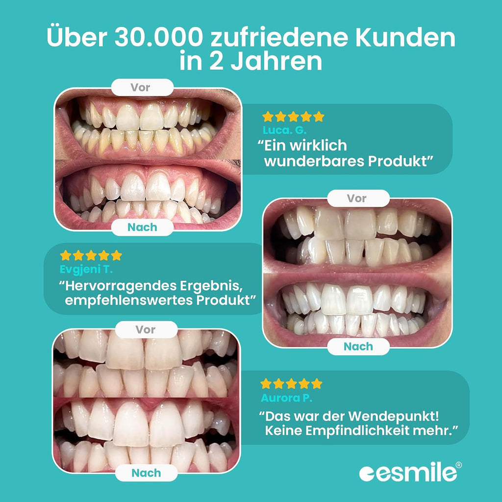Easy Smile Zahnaufhellungsset mit LED-Bleaching Kit inklusive Zubehoer