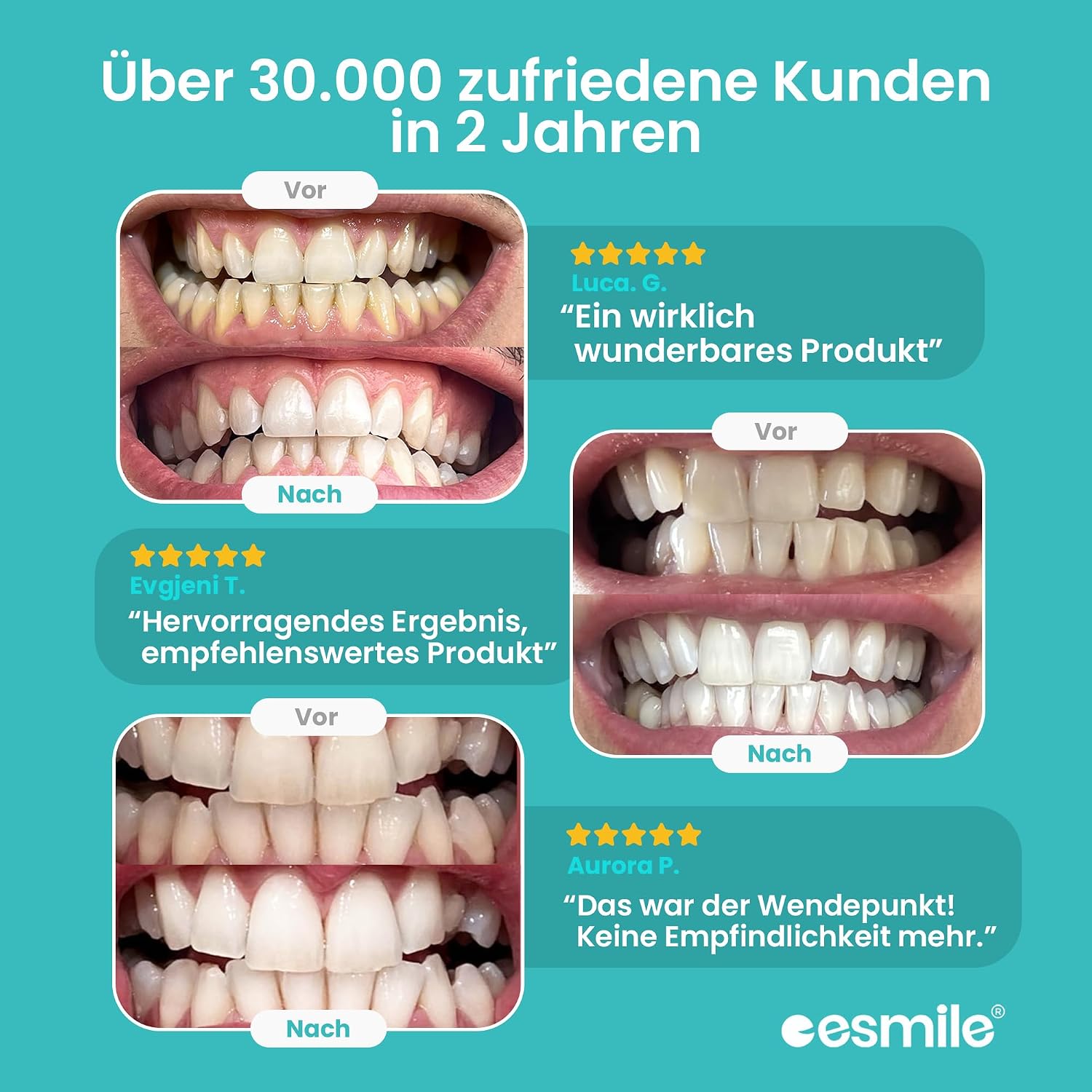 Easy Smile Zahnaufhellungsset mit LED-Bleaching Kit inklusive Zubehoer