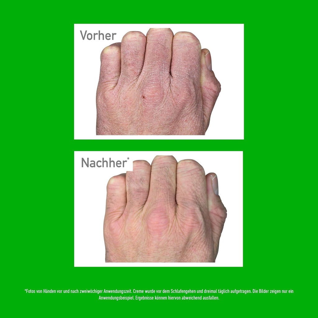O’Keeffe’s Working Hands Handcreme gegen sehr trockene rissige Haende