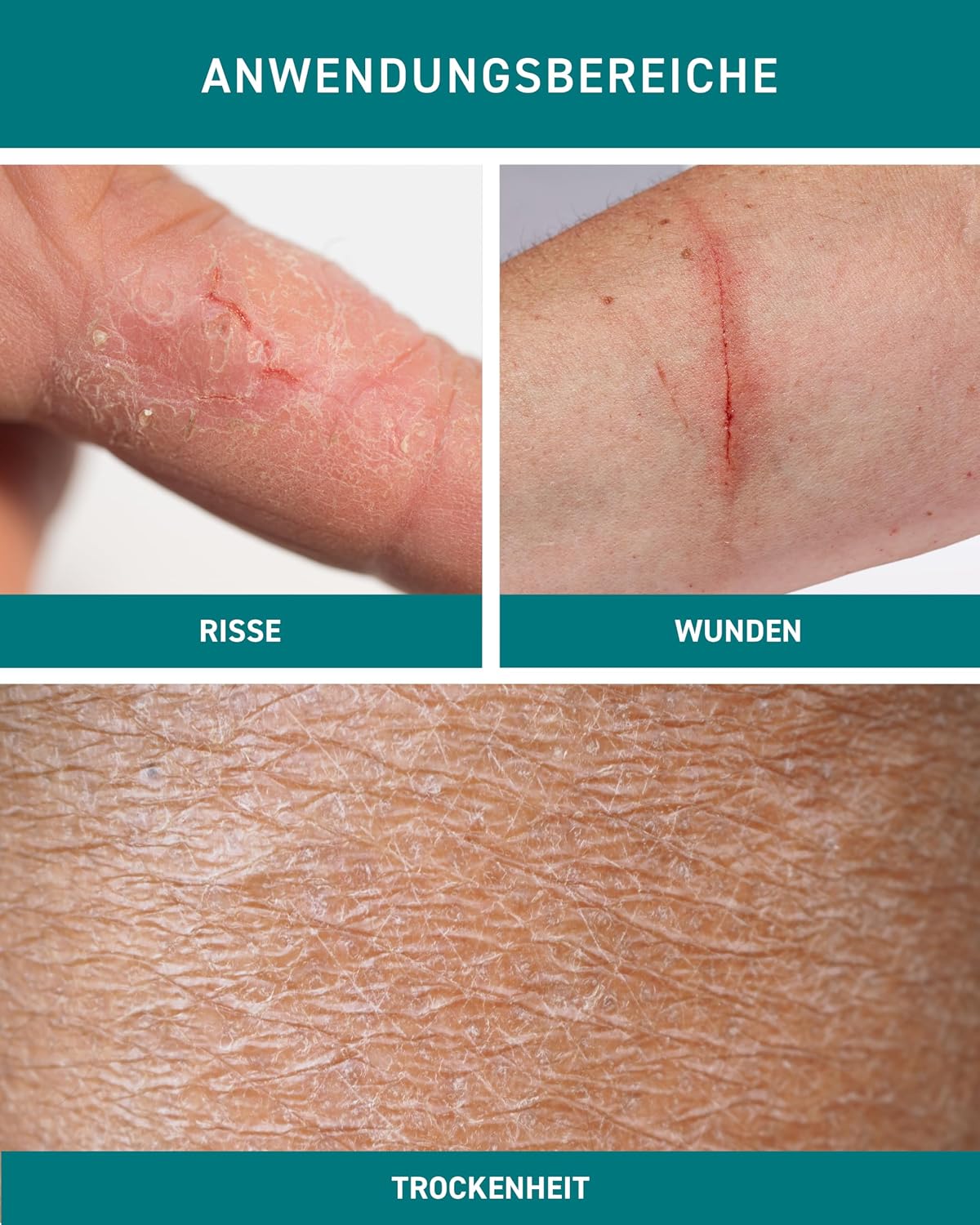 N1 Mikrosilber Handcreme fuer sehr trockene Haende mit Desinfektion