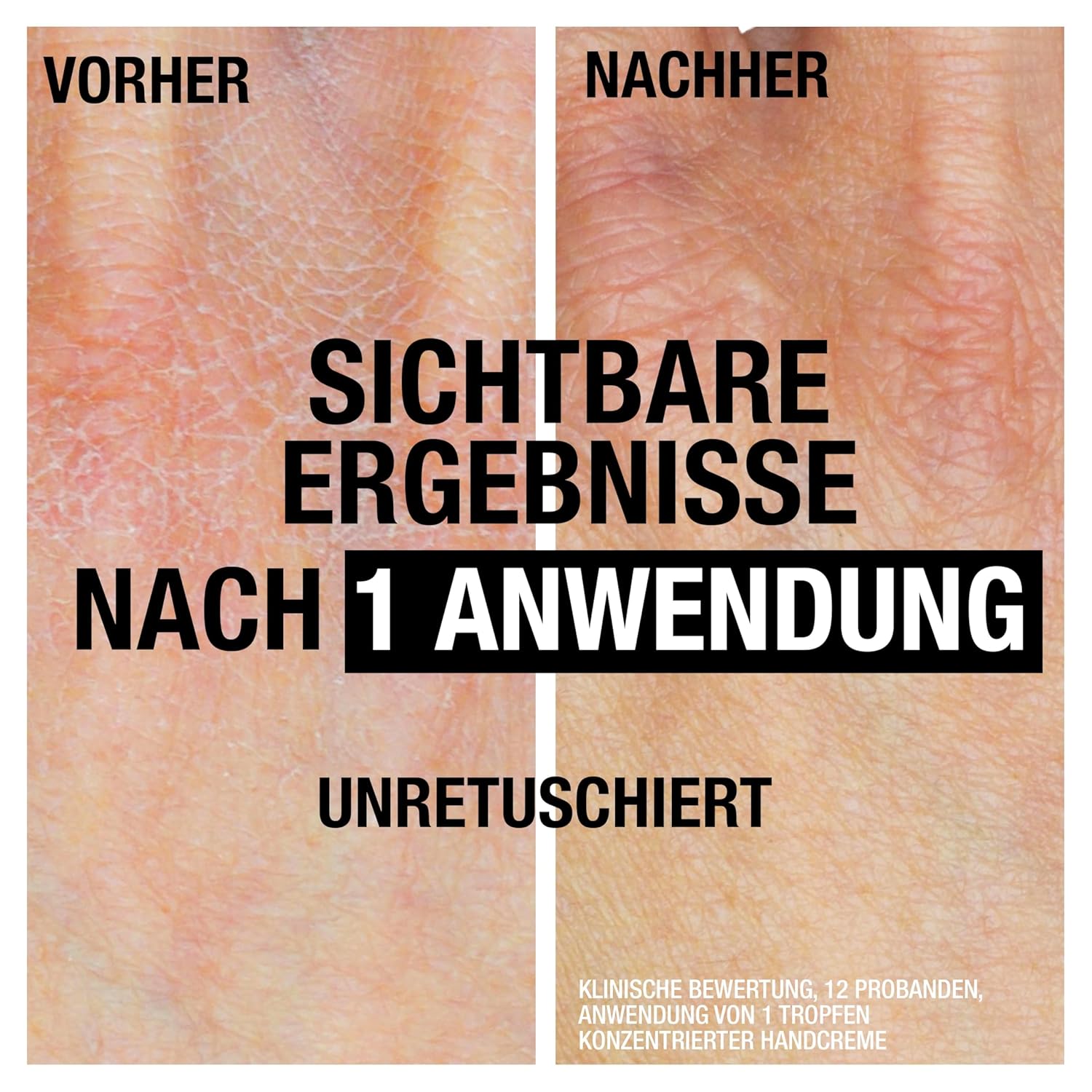Neutrogena Intense Repair CICA Handcreme fuer sehr trockene Haende