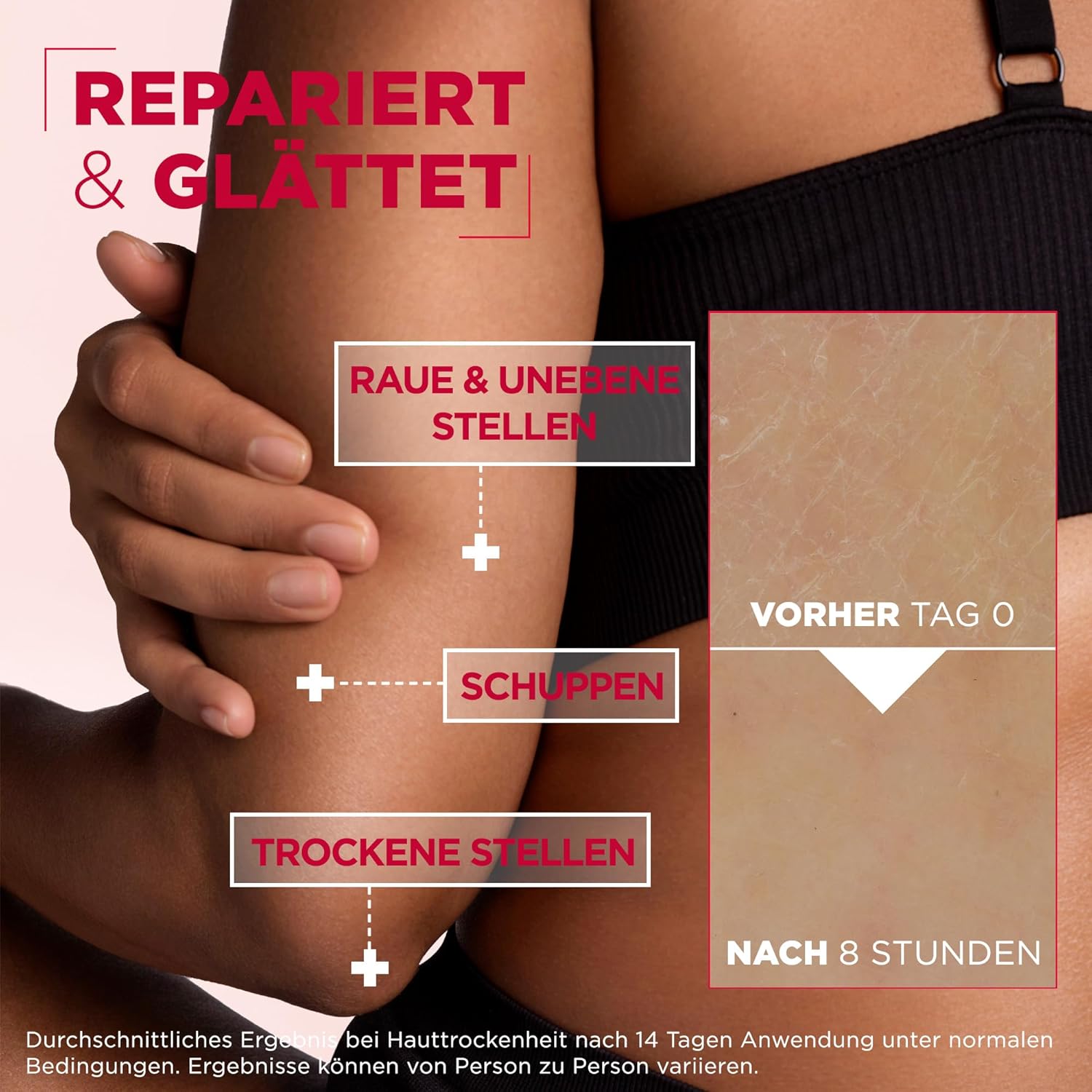 Mixa Urea Cica Repair Koerpercreme 400 ml fuer trockene rissige Haut