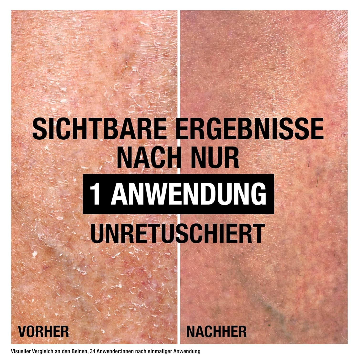 Neutrogena Norwegian Formula Cica Body Balm Pflege sehr trockene Haut